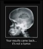 tumor-x-ray.jpg