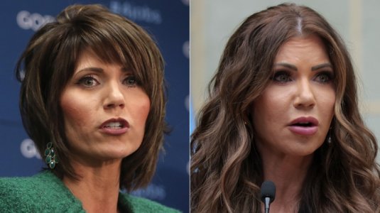 a-plastic-surgeon-believes-kristi-noem-could-have-had-a-face-and-neck-lift-1751299702.jpg