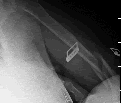 Image17.gif