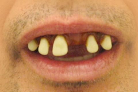 toothless.jpg