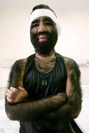 hairyguy.jpg