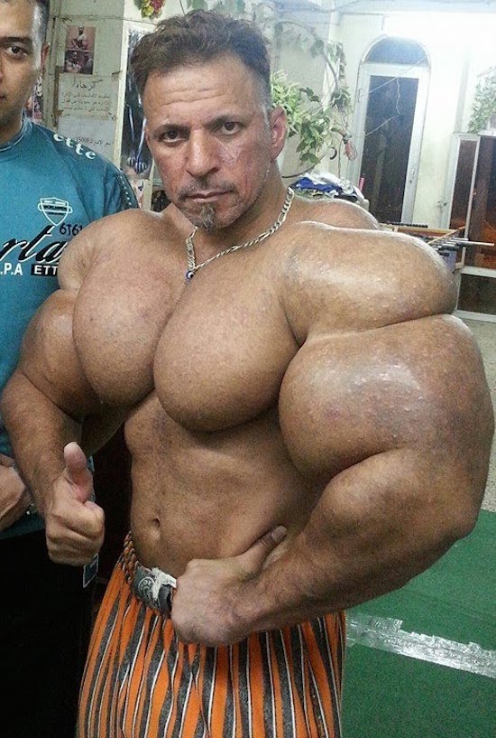 synthol-and-steroid-bodybuilder-1.jpg